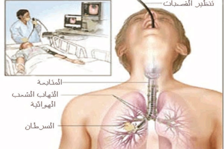 البروفيسور لشهب يدعو   إلى التحسيس بمسببات المرض