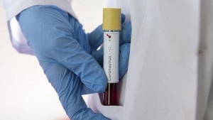 لا وفاة.. 11 إصابة جديدة وشفاء 11 مريضا