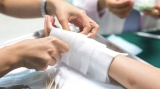 برنامج طبي هام في جراحة الحروق